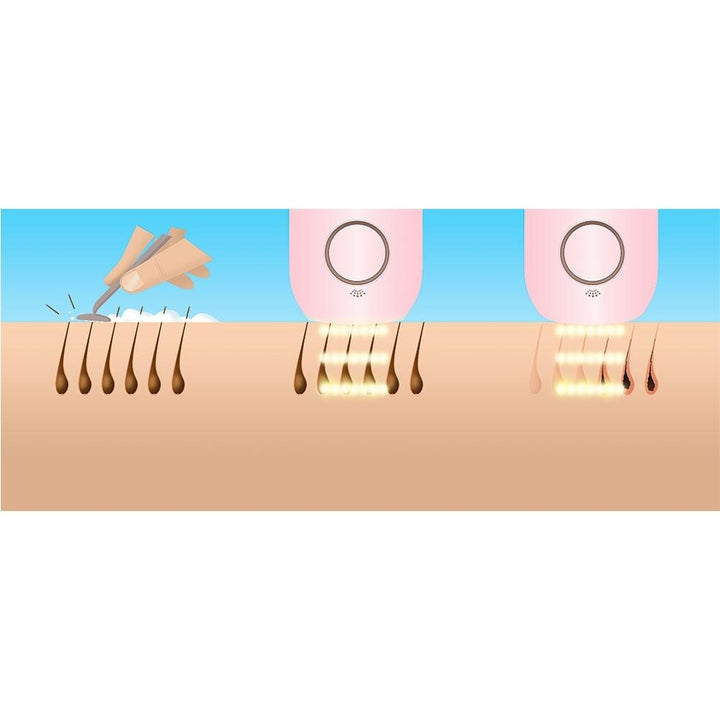 Artist rendering of the Homedics Duo Lite Permanent Hair Reduction compared to traditional shaving