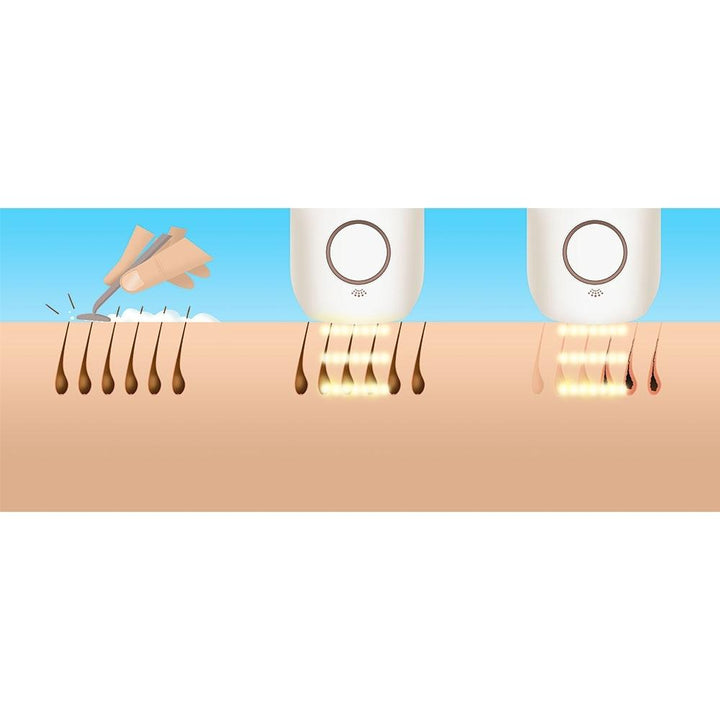 Artist rendering of Homedics Duo Quartz Permanent Hair Reduction device results compared to shaving